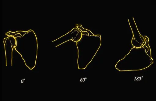 scapulothoracique-4