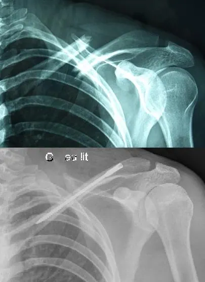 vis-dual-track