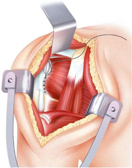 fermeture-1 (1)
