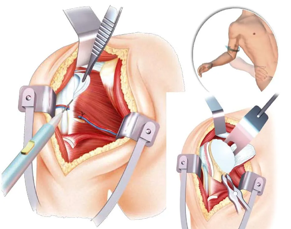 section-sous-scap